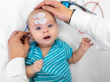 A baby in a blue striped onesie lies on a white surface with sensors attached to their forehead, while an adults hands adjust wires on the baby’s head, likely during a medical test or examination.