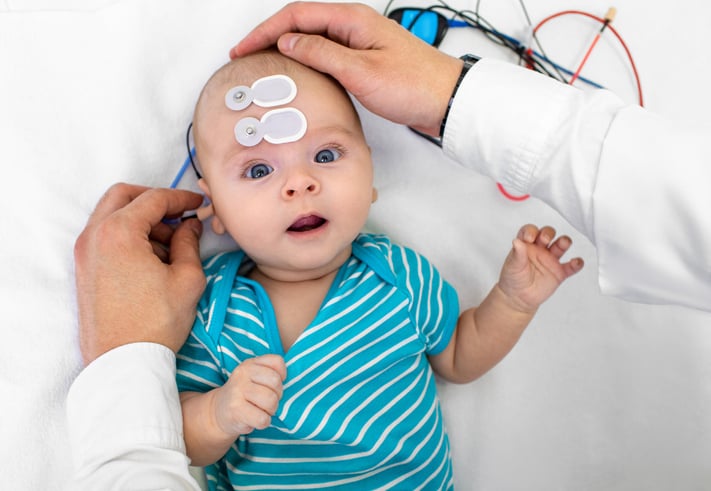 A baby in a blue striped onesie lies on a white surface with sensors attached to their forehead, while an adults hands adjust wires on the baby’s head, likely during a medical test or examination.
