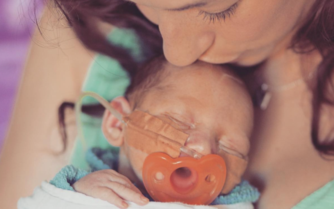 A woman gently kisses the forehead of a sleeping newborn who has medical tape and a tube on their face, and is holding an orange pacifier. The baby is wrapped in a blanket, showing a moment of tenderness and care.
